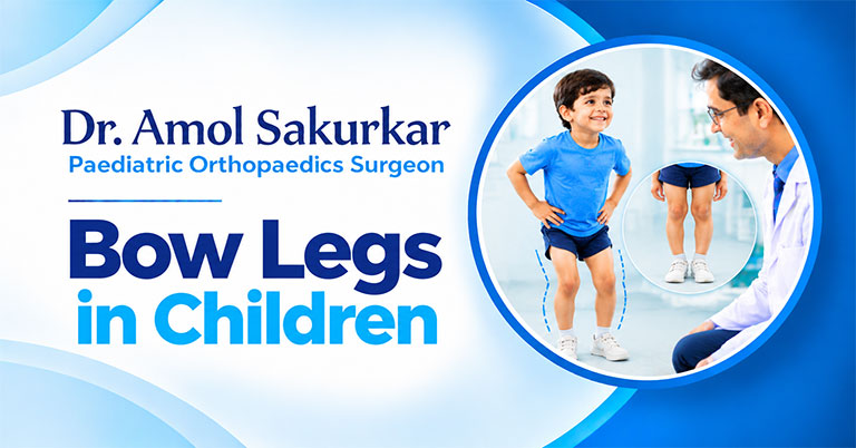 Bow Legs in Children: What Parents Should Know